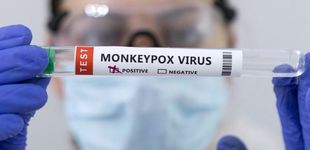 Post de Mapa de la viruela del mono en España: casos confirmados y sospechosos
