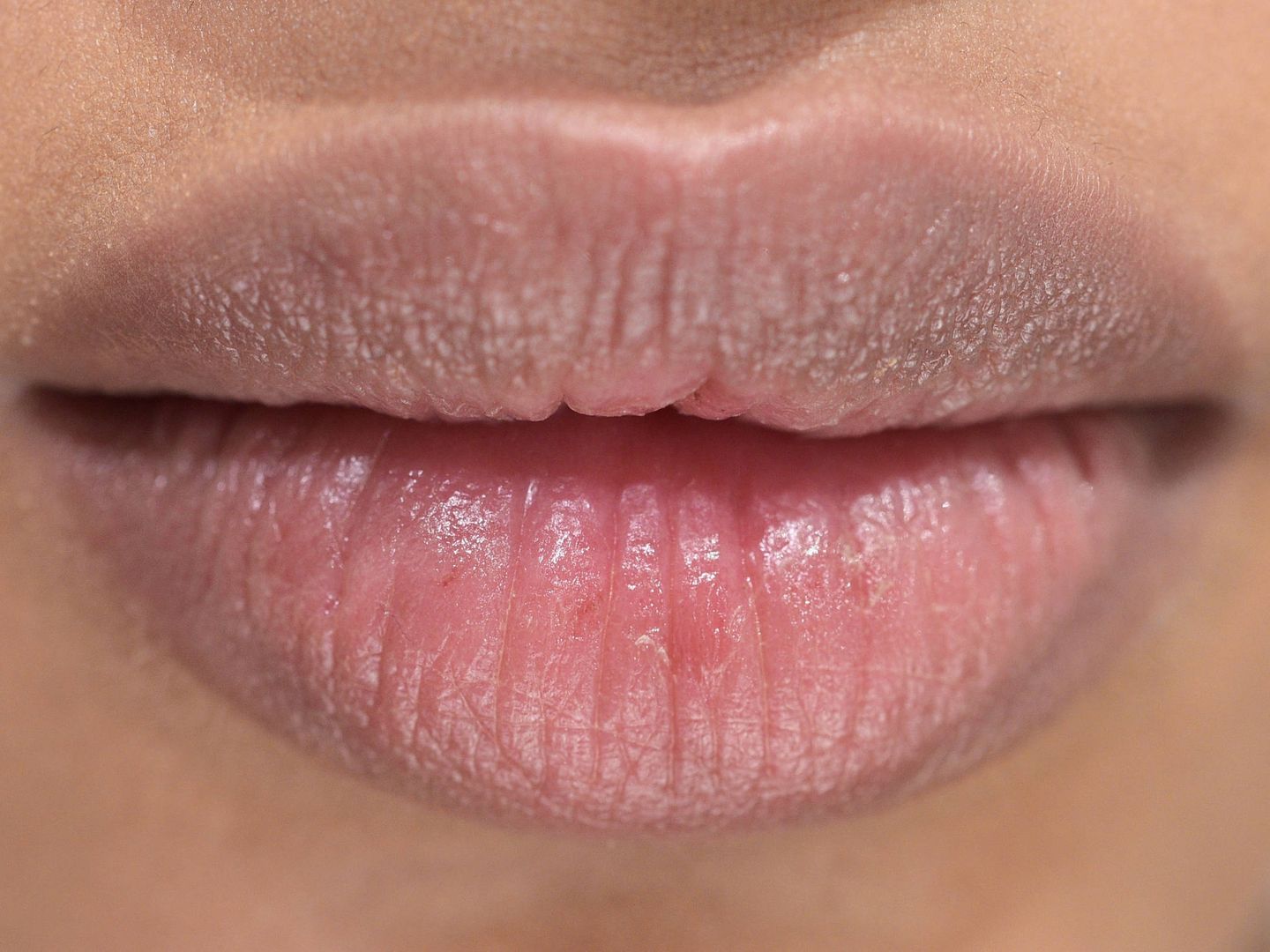 El labios superior suele ser el primero en perder volumen. (Getty)
