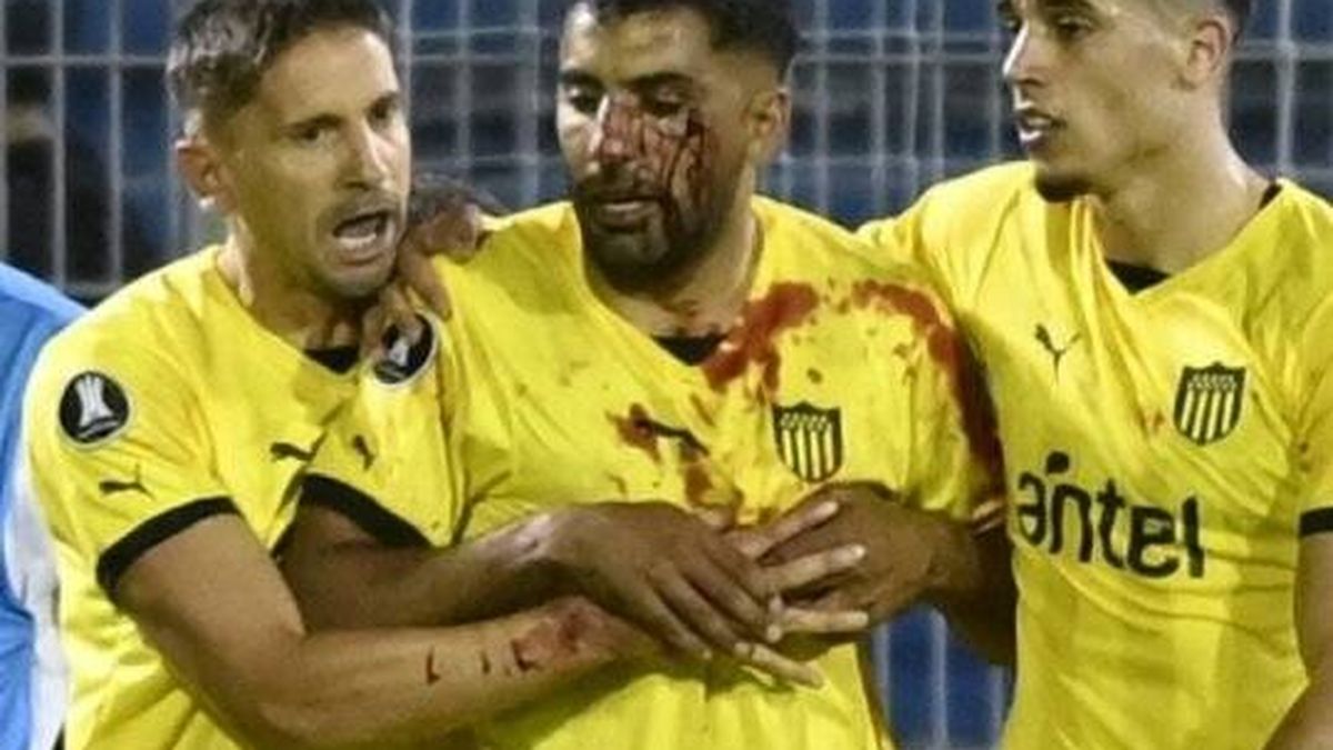 Vallas, bengalas, pedradas y sangre sobre el campo: el vergonzoso episodio en la Libertadores