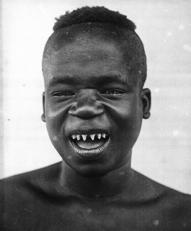 Foto: Retrato de Ota Benga tomada en el Congo. Sus afilados dientes eran una práctica común entre los hombres jóvenes de su tribu. (American Museum of Natural History)