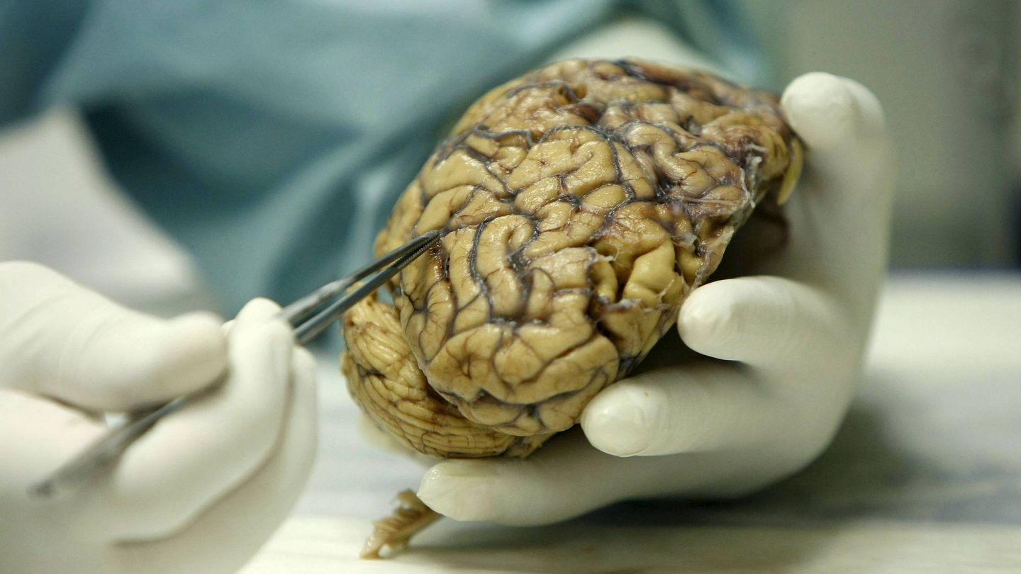 Cerebro en un banco de cerebros convencional. (EFE)