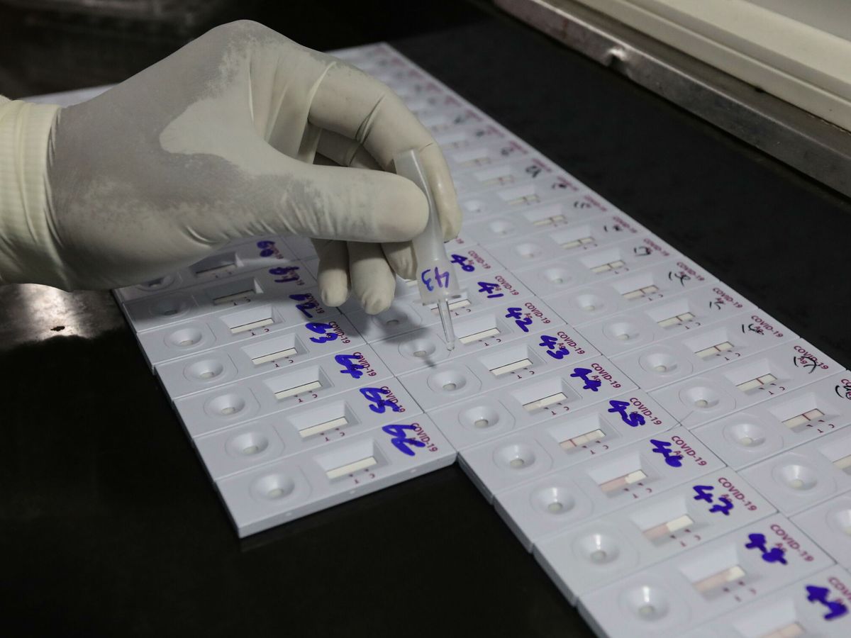 Foto: Varios test de antígenos en un laboratorio. (EFE)