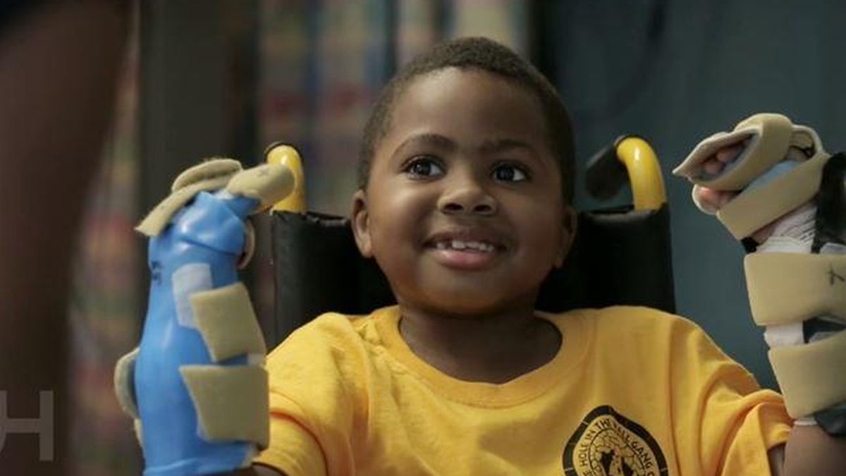 Un niño de ocho años recupera las dos manos tras un doble trasplante