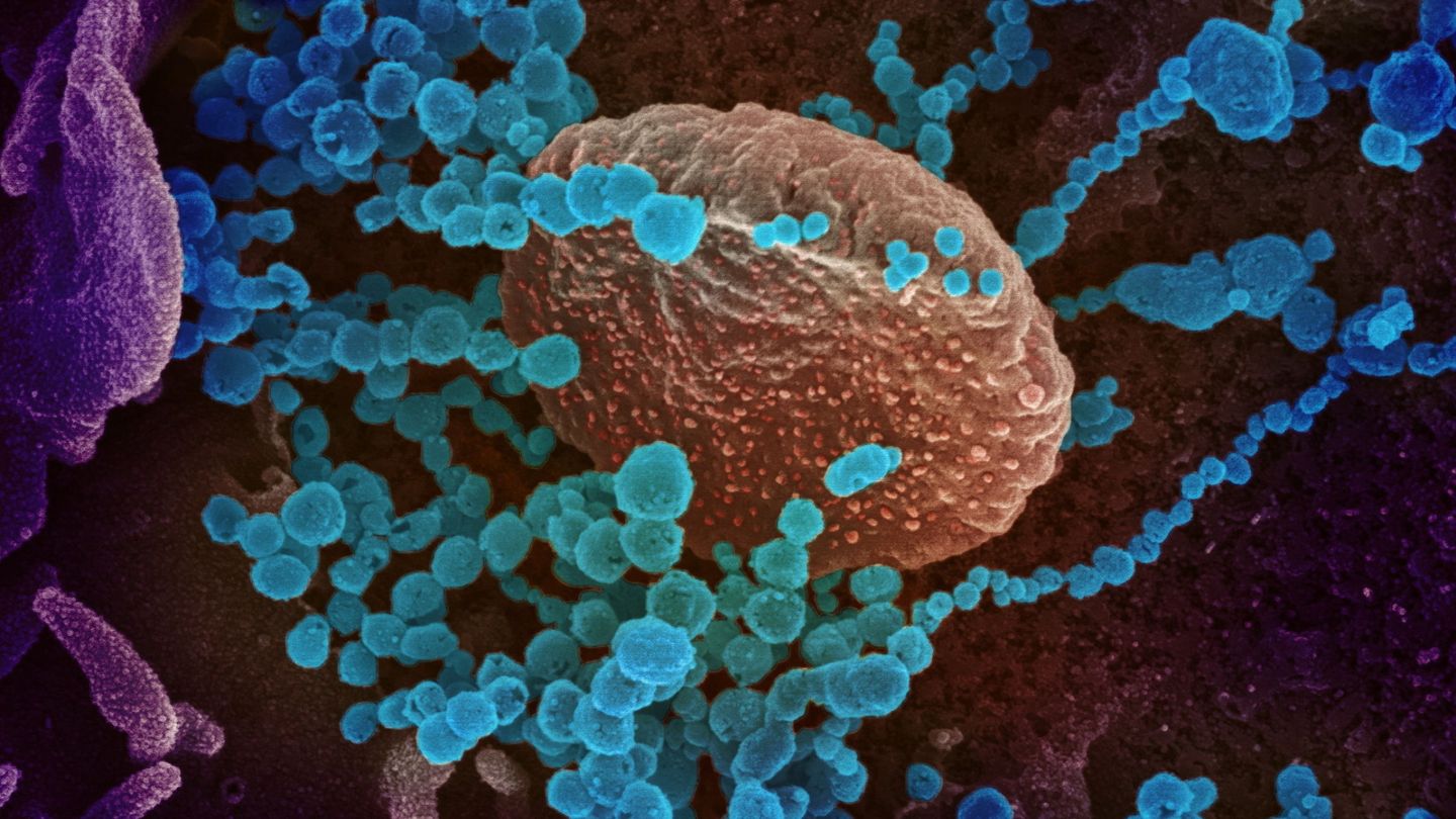 Todo lo que aparece en una imagen microscópica tiene potencial de asustar. (NIH)