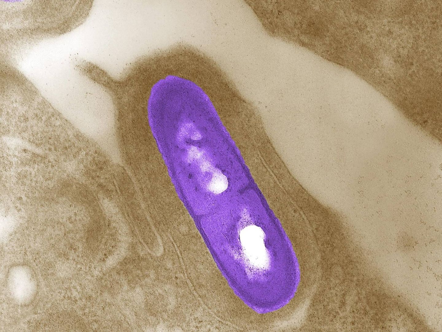 Imagen microscópica de una bacteria Listeria monocytogenes. (Reuters)