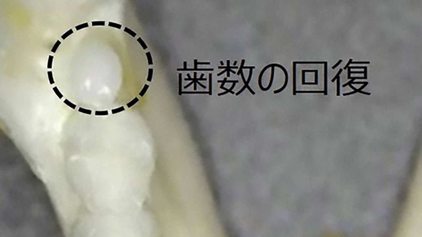 Un nuevo diente en un ratón tratado con el medicamento. (Katsu Takahashi)