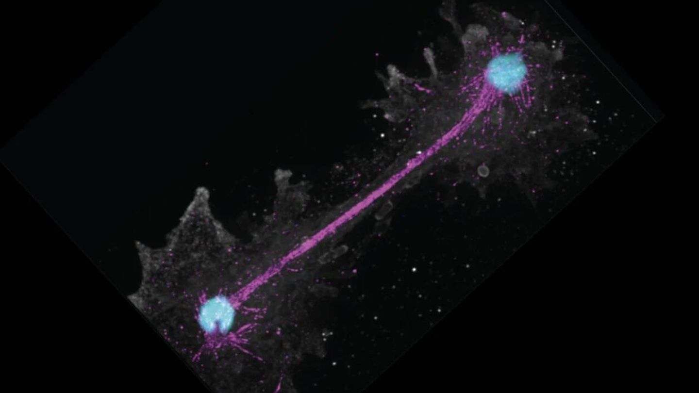 Célula de 'Incendiamoeba' en mitosis a 63 ºC (Felix Mikus/CC BY-SA)