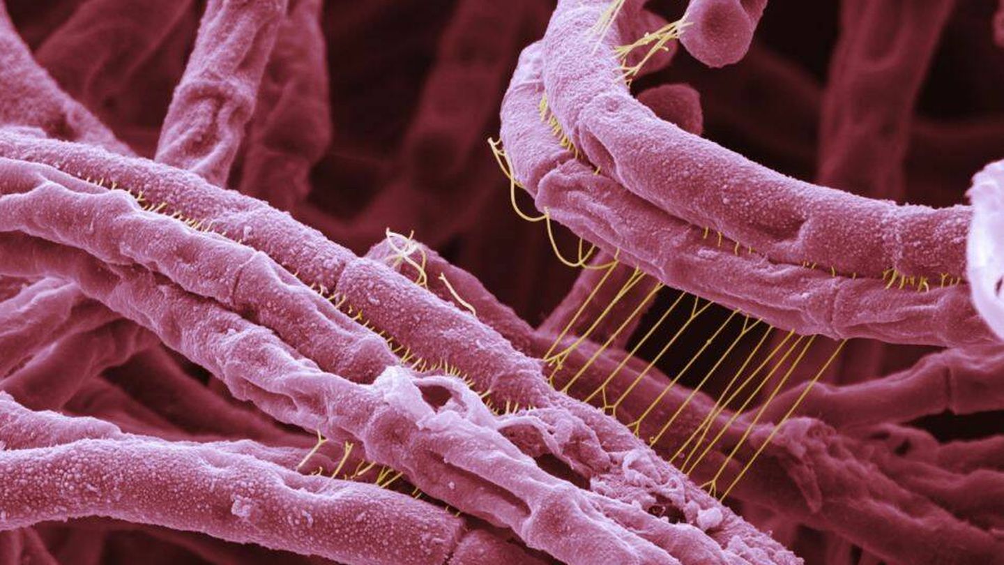 Anthrax bajo el microscopio