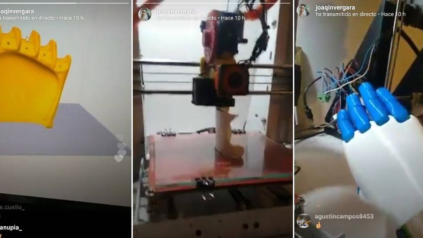 Joaquín Vergara muestra en su Instagram el proceso de creación de una prótesis (@joaqinvergara)