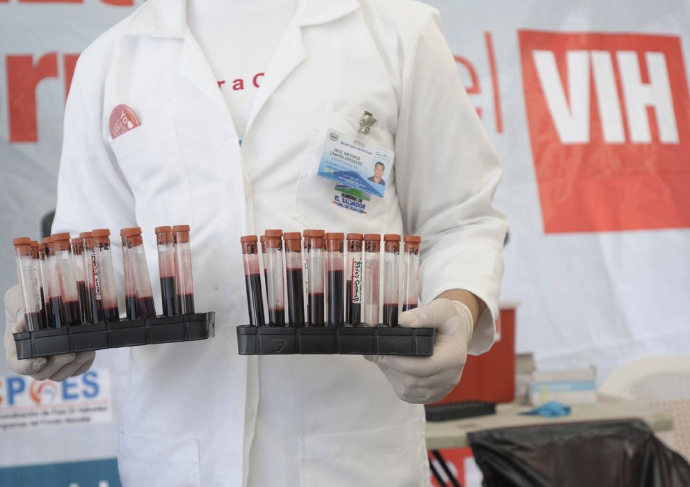 Foto: Muestras de sangre de pacientes a los que se les ha practicado la prueba del VIH (Efe)