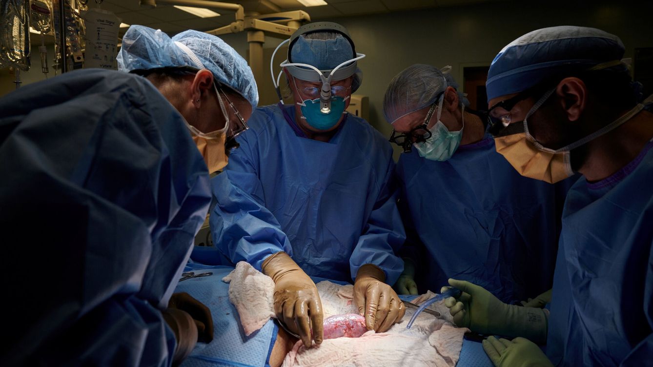 Foto: El primer trasplante de un riñón de cerdo. (Reuters)