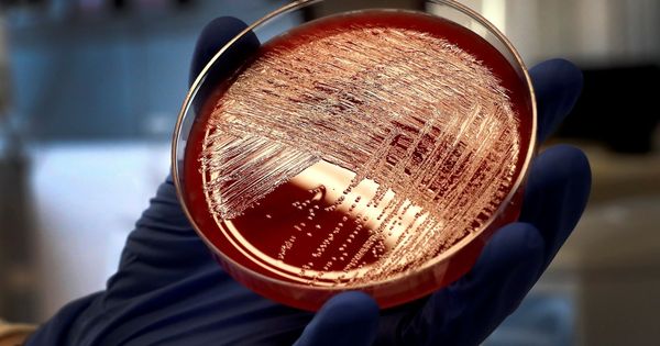 Foto: Vista de un cultivo de listeriosis en una placa de Petri. (EFE)