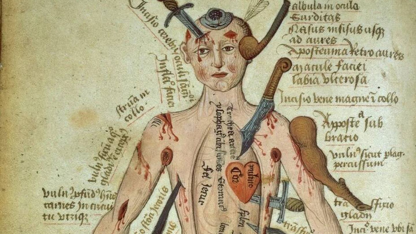 Hombre herido, Pseudo-Galen, Anathomia; WMS 290. Manuscrito publicado entre los siglos XV y XVI. (Wikimedia)