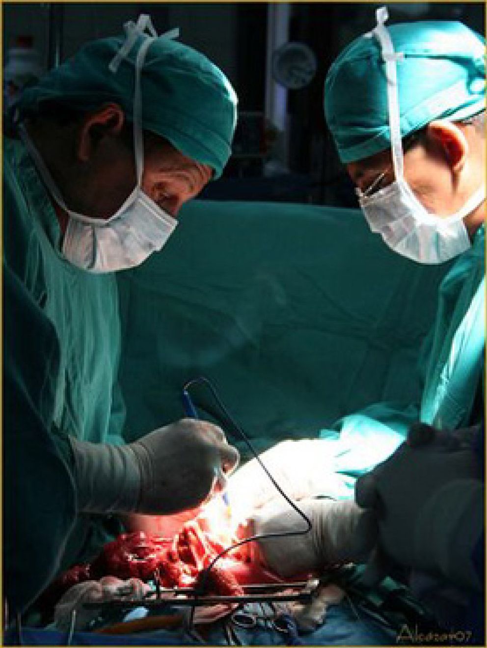 Foto: La lista de espera para una cirugía bariátrica en la Comunidad valenciana es de cuatro años