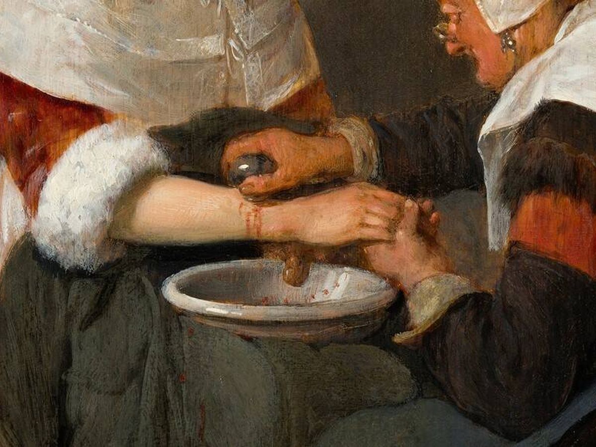Foto: Detalle de un cuadro de Quirijn van Brekelenkam donde aparece una anciana sangrando a una joven mediante el método de la sangría. (Wikimedia)