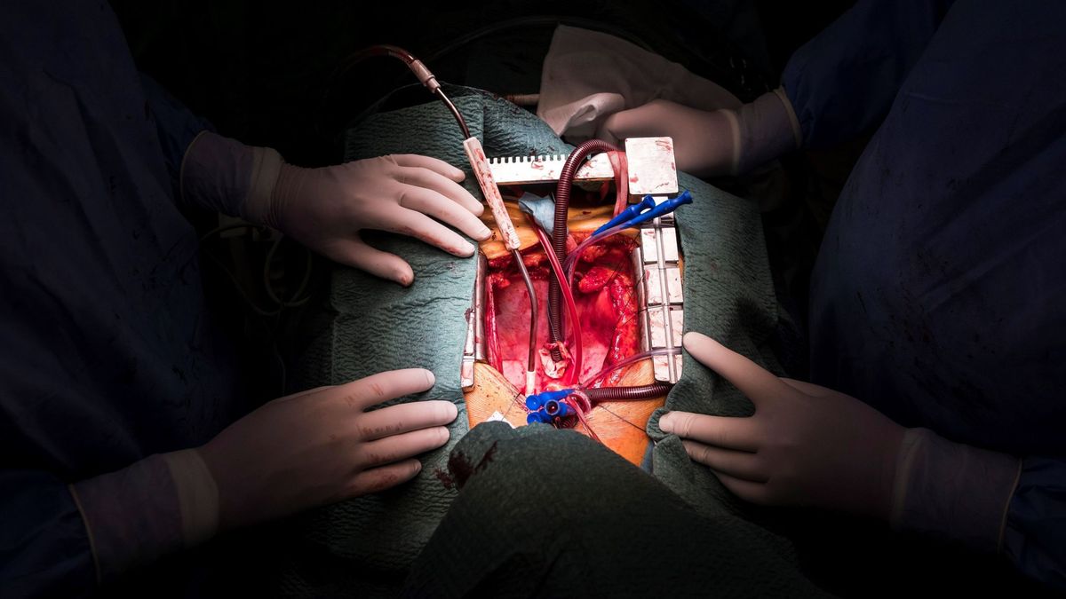 Primer trasplante de músculo cardíaco: ¿el fin de los trasplantes de corazón?