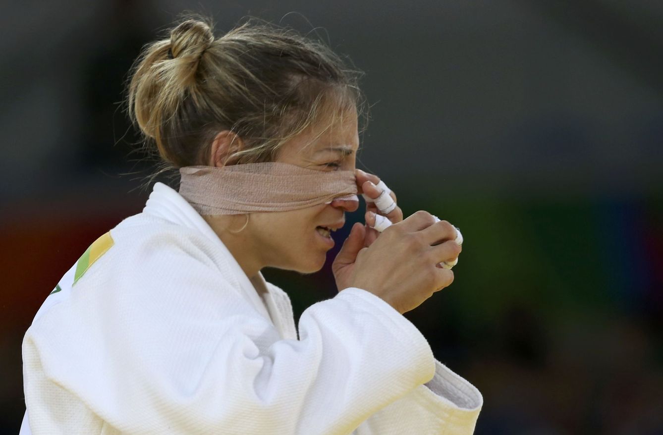 Laura Gomez con el golpe en su nariz durante el combate (Toru hanai/REUTERS)