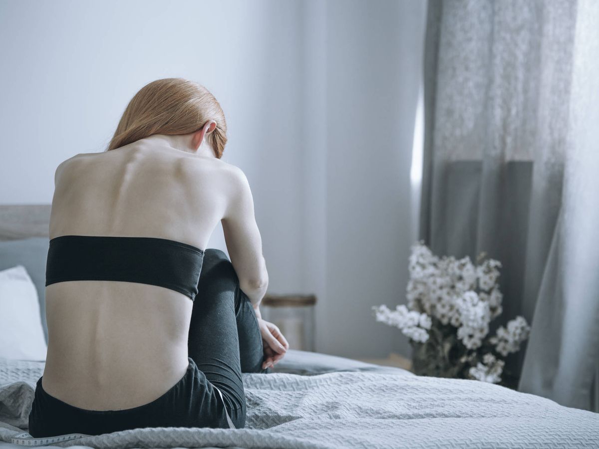 Foto: Mujer con anorexia. Foto: iStock