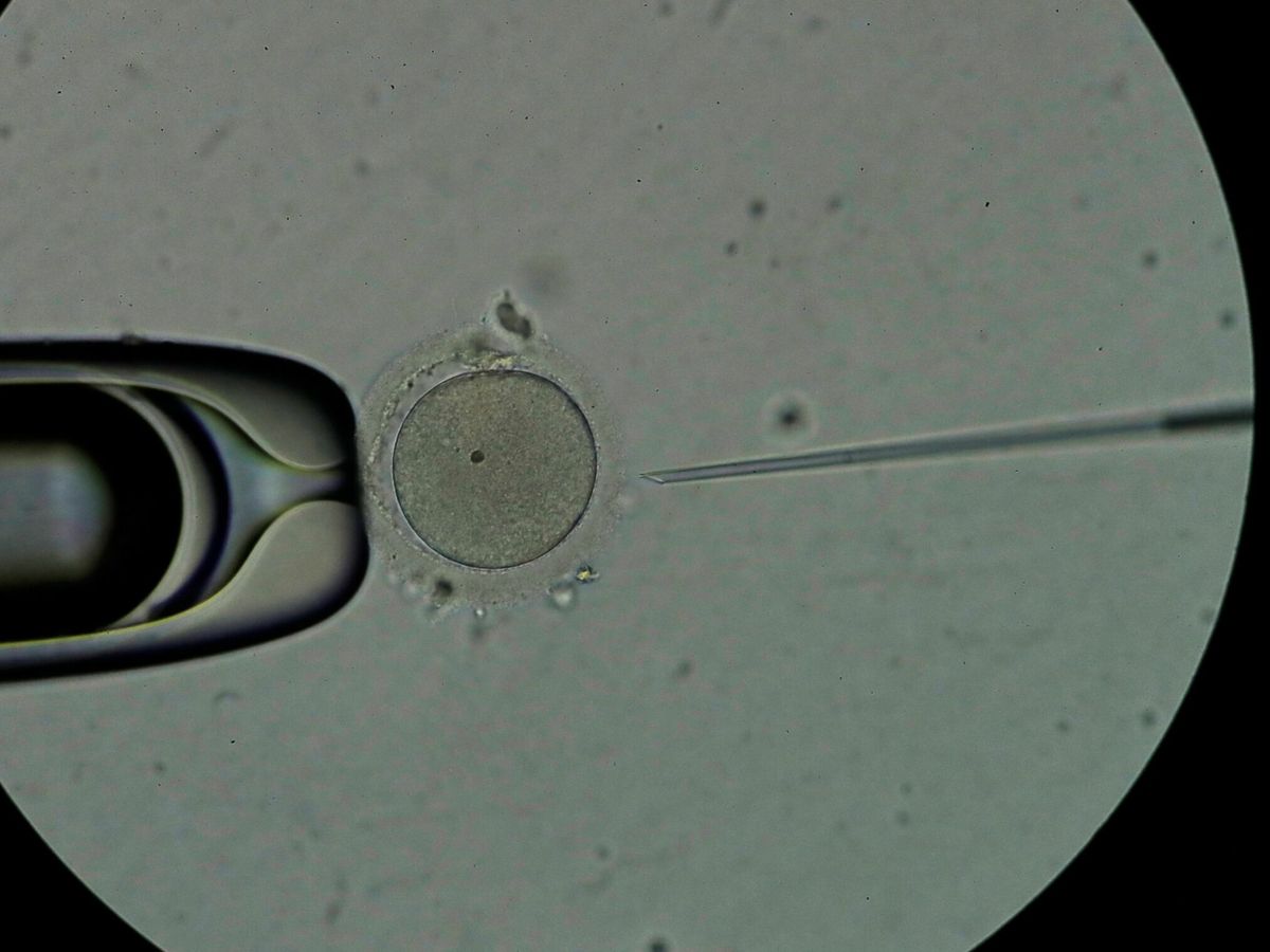 Foto: Los embriones llevaban congelados desde 1992 (EFE/Bienvenido Velasco)