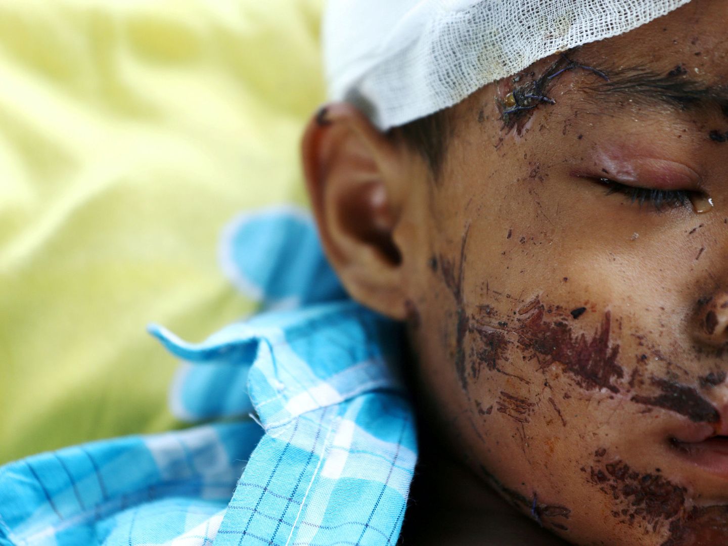 Niño herido en el terremoto de Indonesia en 2018 (Reuters)
