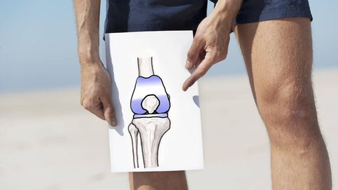 Los médicos quieren predecir si tu dolor de rodillas seguirá después de operar