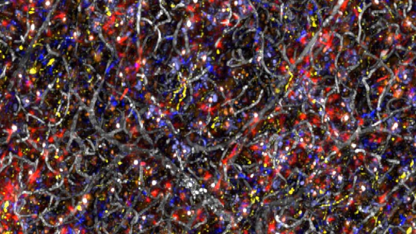 Los colores muestran diferentes células, conexiones y proteínas. (Chung Lab/MIT Picower Institute)