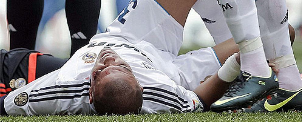 Foto: Pepe abandona el hospital y es una baja más que posible ante el Barcelona en la Supercopa