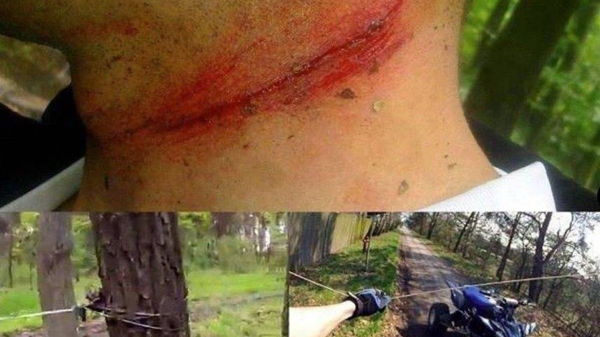 Nueva víctima en bicicleta de un 'cable trampa': crece la advertencia de este peligro