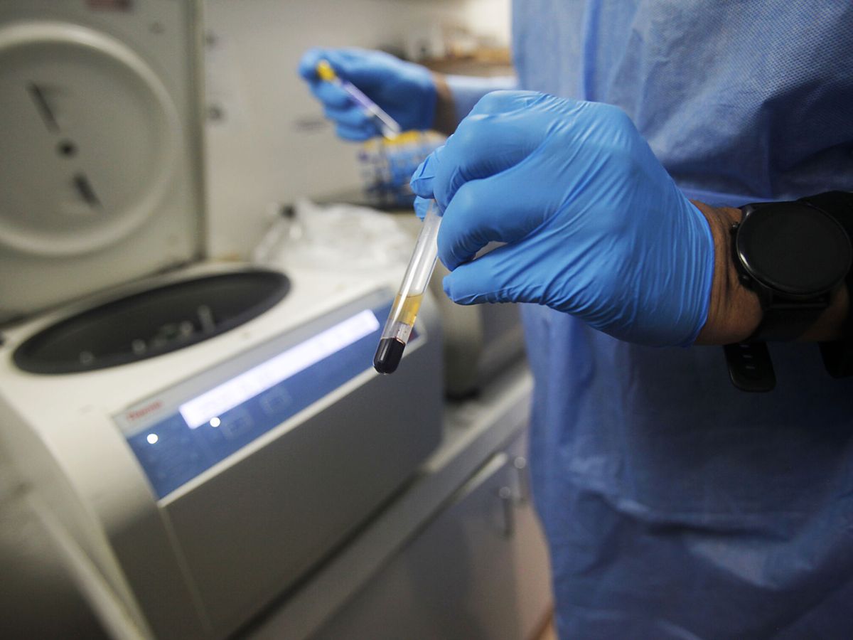 Foto: Una muestra para un examen de VIH. (EFE/Carlos Lemos)