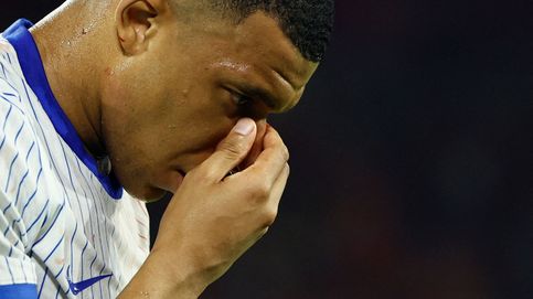 Los riesgos de jugar con la nariz rota: esto es lo que podría suceder a Mbappé si sigue jugando en la Eurocopa con su lesión