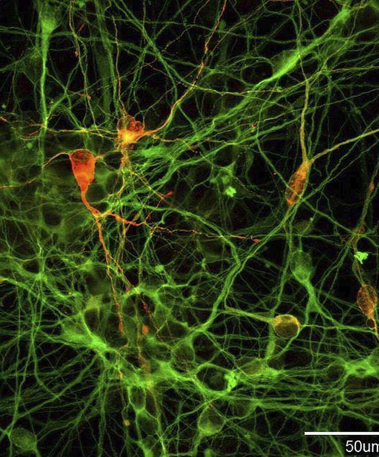 Foto: Neuronas dopaminérgicas obtenidas de células iPS. (EFE/Kyoto University Cira Ho)