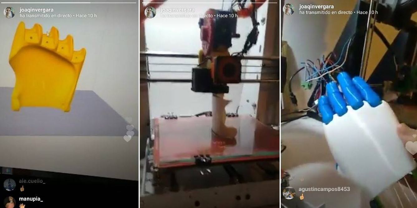Joaquín Vergara muestra en su Instagram el proceso de creación de una prótesis (@joaqinvergara)