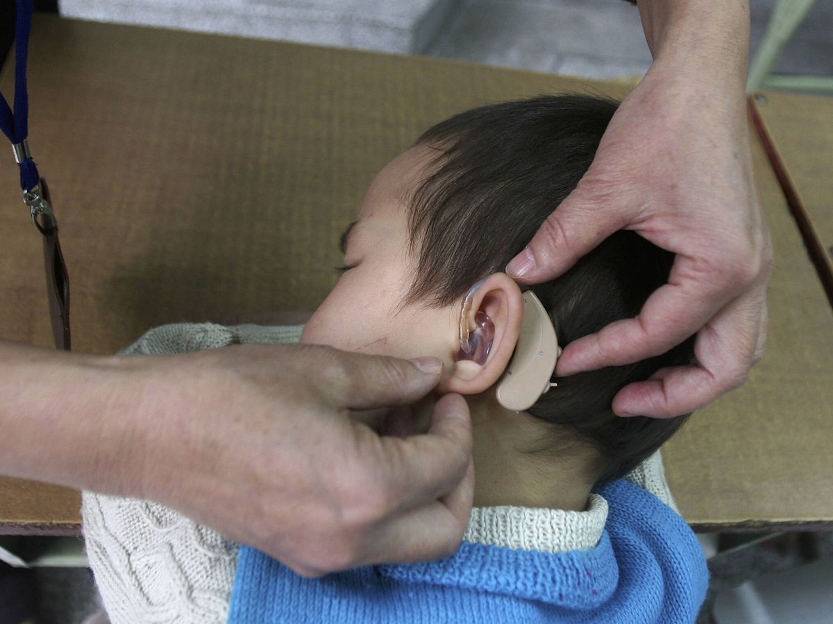 Foto: Un bebé con discapacidad auditiva y audífonos. (Getty)