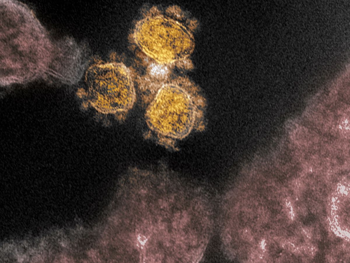 Foto: Imagen microscópica del coronavirus SARS-CoV-2. (NIH)