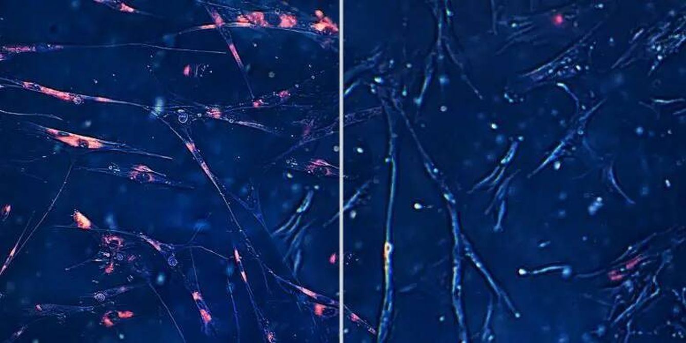 Los senolíticos son una clase emergente de compuestos farmacológicos en investigación que eliminan selectivamente las células senescentes asociadas al envejecimiento (izquierda, con tinción roja) sin afectar a otras células (derecha). (Integrated Biosciences)