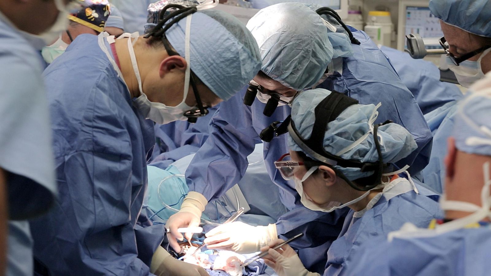 Foto: Un equipo médico practica un trasplante. (EFE)