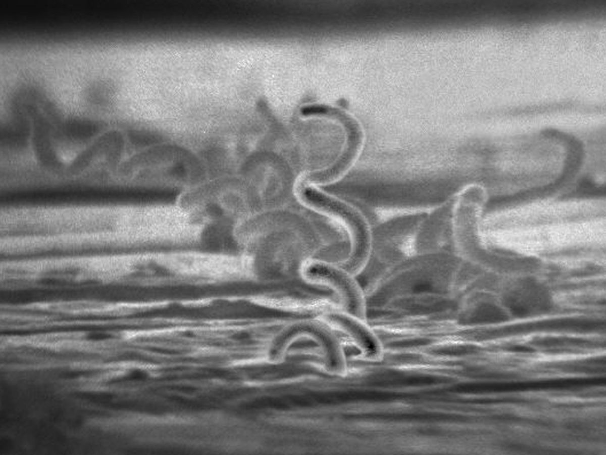 Foto: La bacteria Treponema pállidum, responsable de causar sífilis. (CDC / Dr. David Cox)