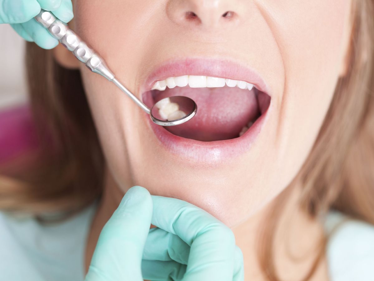 Foto: Ayudas y subvenciones para ir al dentista: requisitos, qué cubre y quiénes pueden solicitarlas. (iStock)