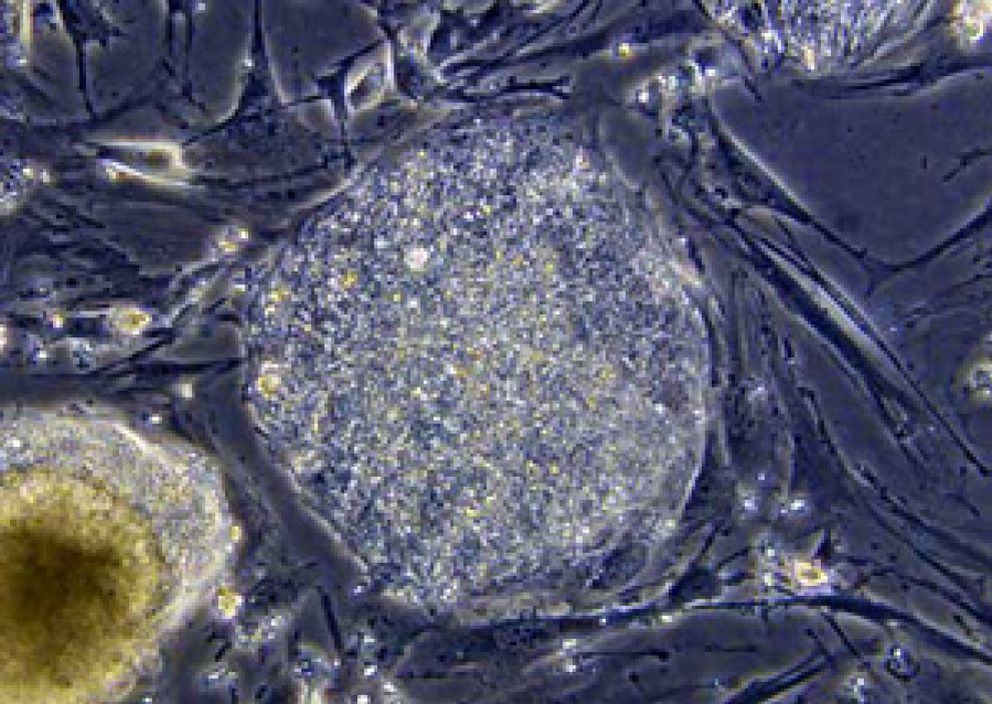 Foto: Científicos descubren el “eslabón perdido” de las células madre