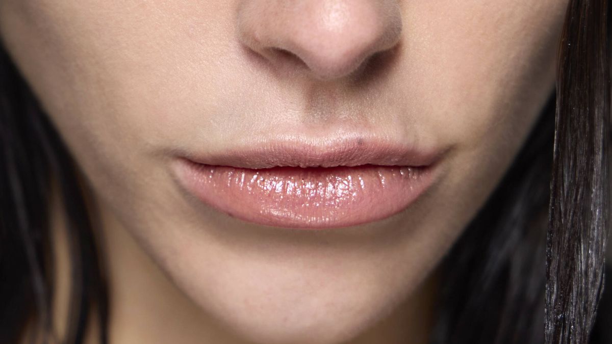 Migración del relleno de labios: cómo evitar que el ácido hialurónico se desplace