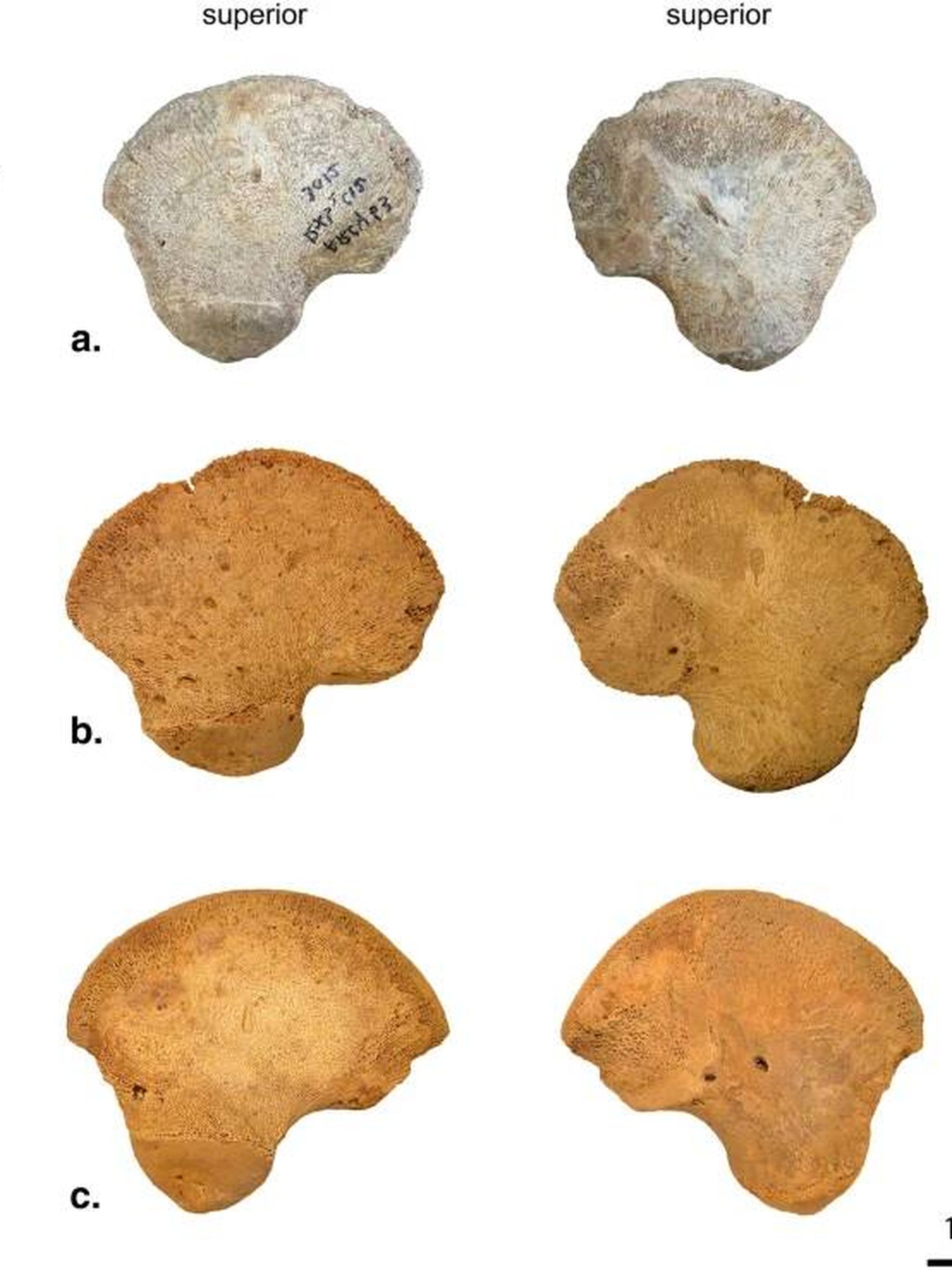 Vista lateral (a la izquierda) y media (a la derecha) del hueso ilión de AR-63 (a), de un recién nacido neandertal (b) y de un niño actual (c).  (Revista 'Scientific Reports')