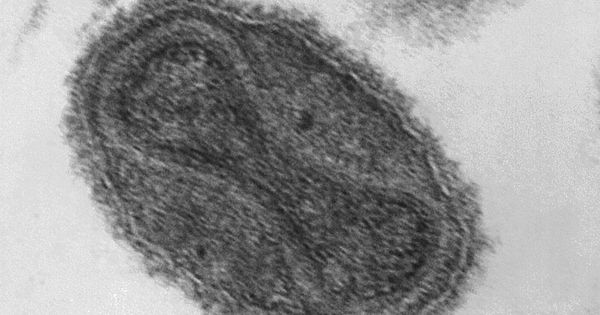 Foto: El virus de la viruela, erradicado completamente gracias a las vacunas