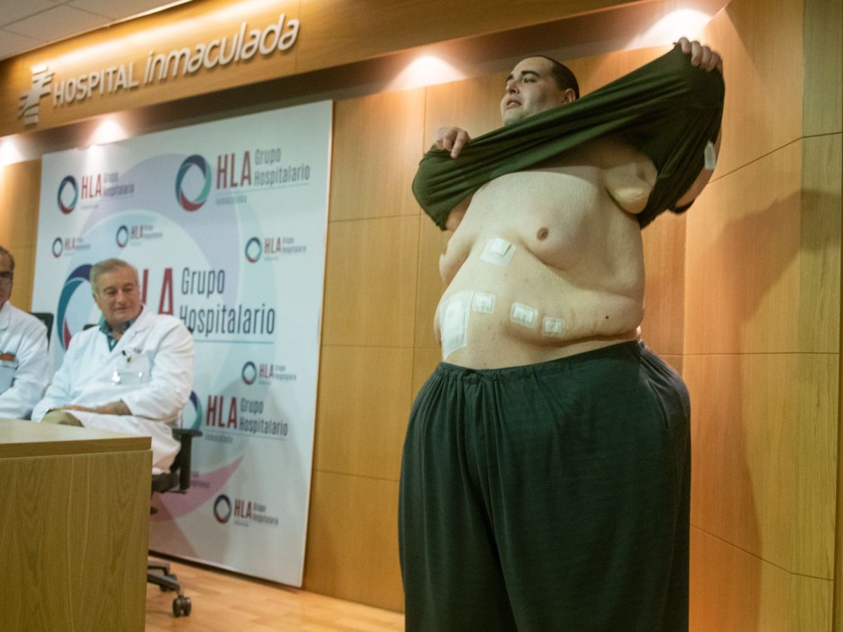 Foto: Joven con obesidad mórbida en el hospital La Inmaculada, en Granada. (EFE)