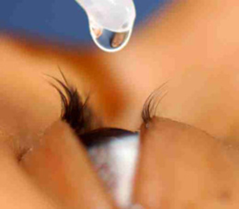 Foto: Frotarse los ojos provoca queratococo y diversas alergias