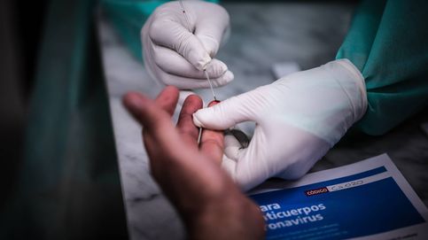 Sanidad registra 11.815 contagios nuevos de coronavirus y 149 fallecidos más