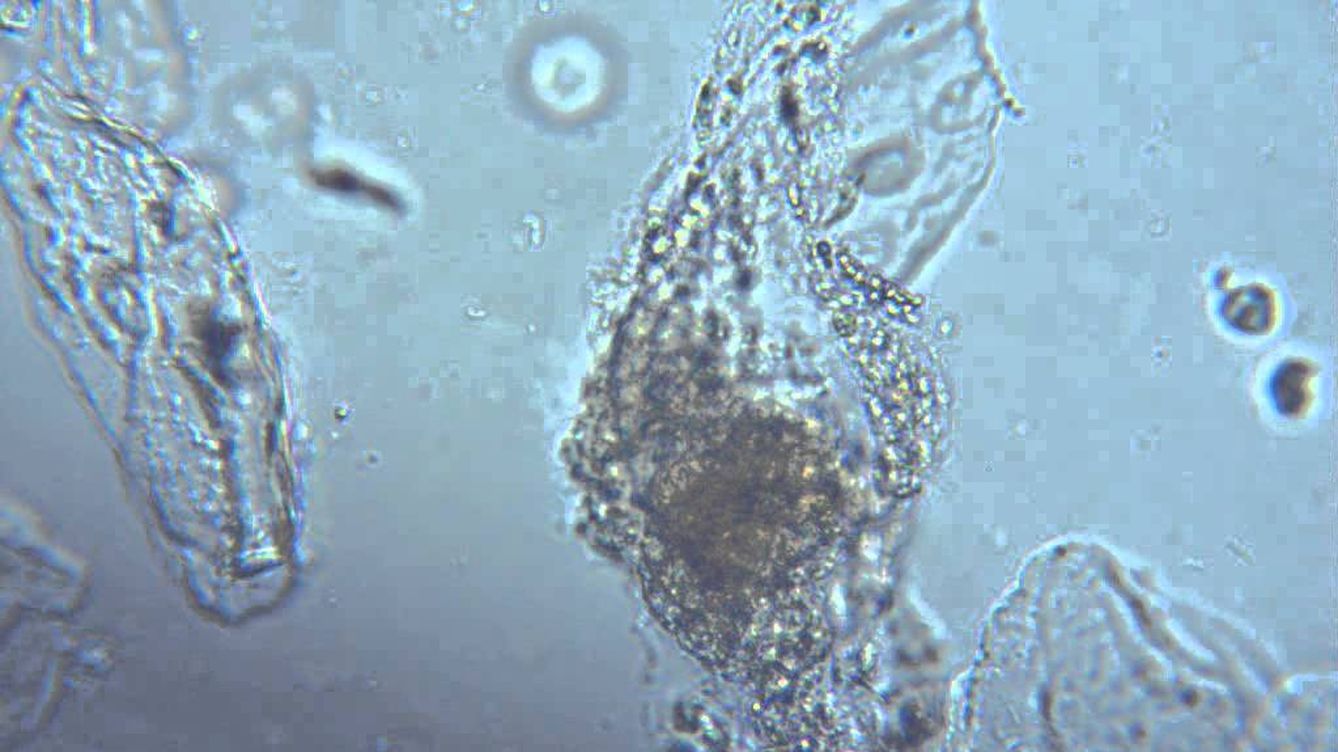 Бактерии в слюне. Слюна под микроскопом. Слюни под микроскопом. Микробы в слюне под микроскопом. Ротовая жидкость под микроскопом.