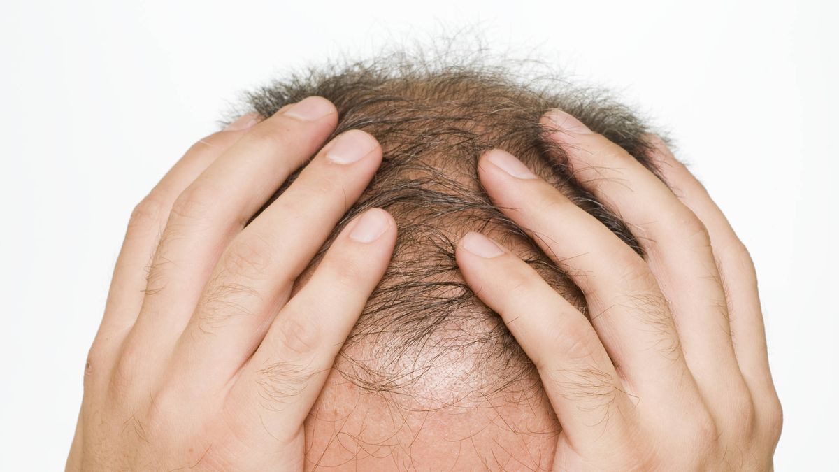 ¿Se te ha caído el pelo más de lo normal? Los efectos de 2020 en la salud de tu cabello