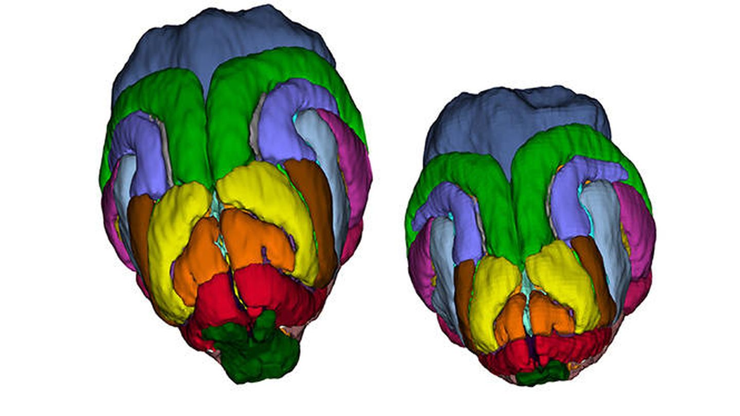 El cerebro de un hurón normal y, a la derecha, el de uno modificado. (Walsh Lab / HHMI / Boston Children’s Hospital)