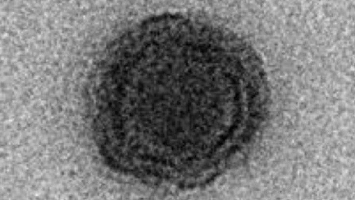 Descubren el yaravirus, un virus hasta ahora desconocido con genes no identificados