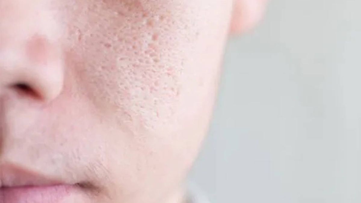 Limpiador Facial Electrico Maquina Cepillo De Cara Para Poros Puntos Negros  Piel